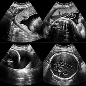 Fetal Growth and well-being studies